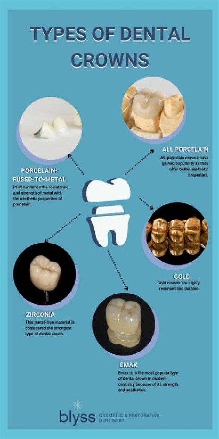 Are crowns good for bruxism?