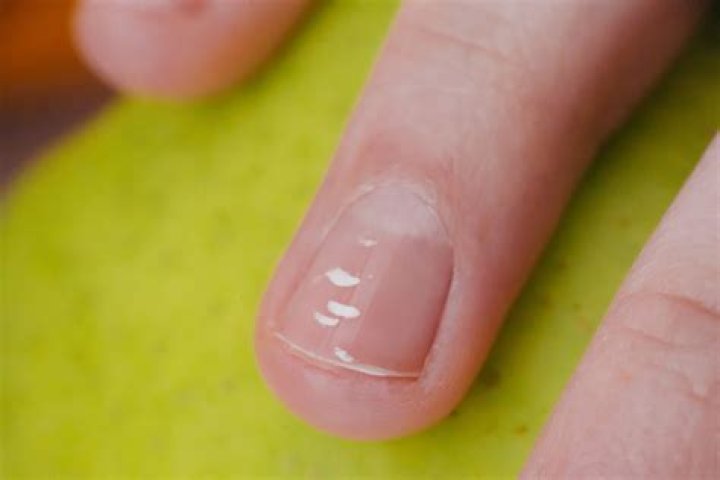 Are gel nails supposed to chip?