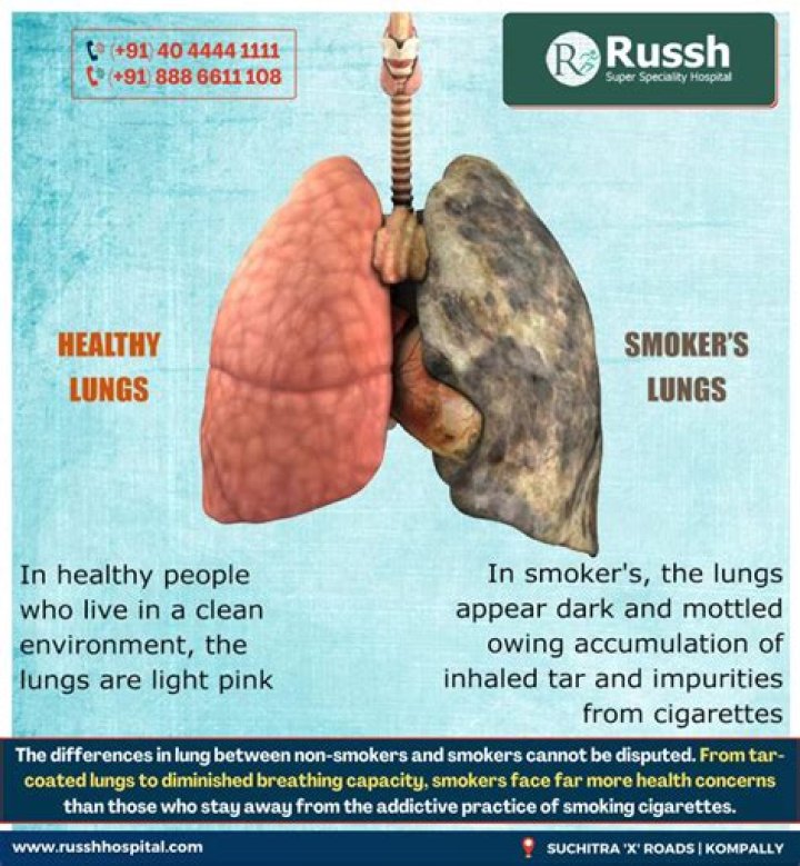 Are smokers more likely to develop severe symptoms with COVID-19?