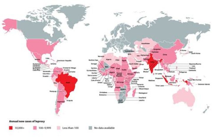 Are there still leper colonies in the world?
