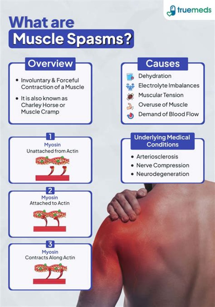 Can a muscle spasm feel like a heart attack?