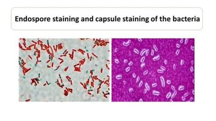 Can acid-fast bacteria be Gram stained?