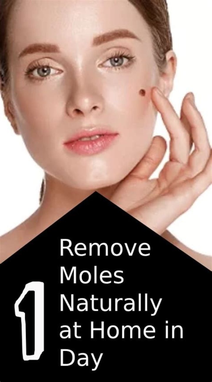 Can aloe vera remove moles?