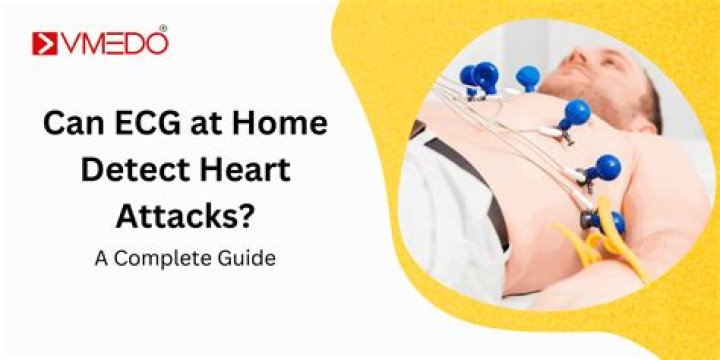 Can an ECG detect heart murmurs?