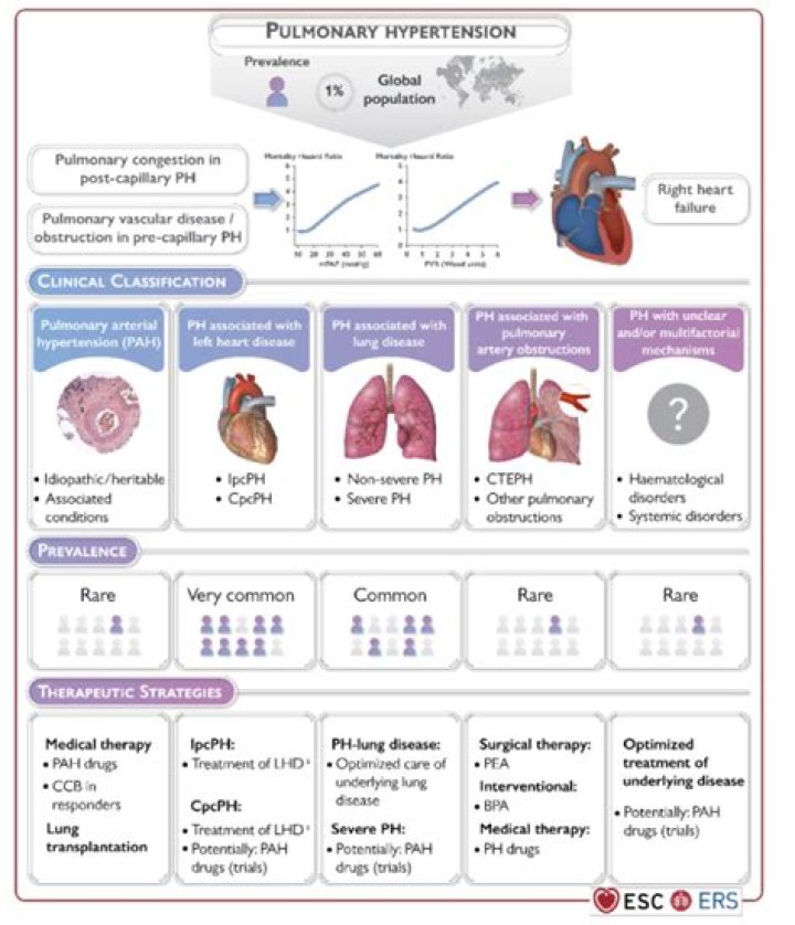 Can babies survive pulmonary hypertension?