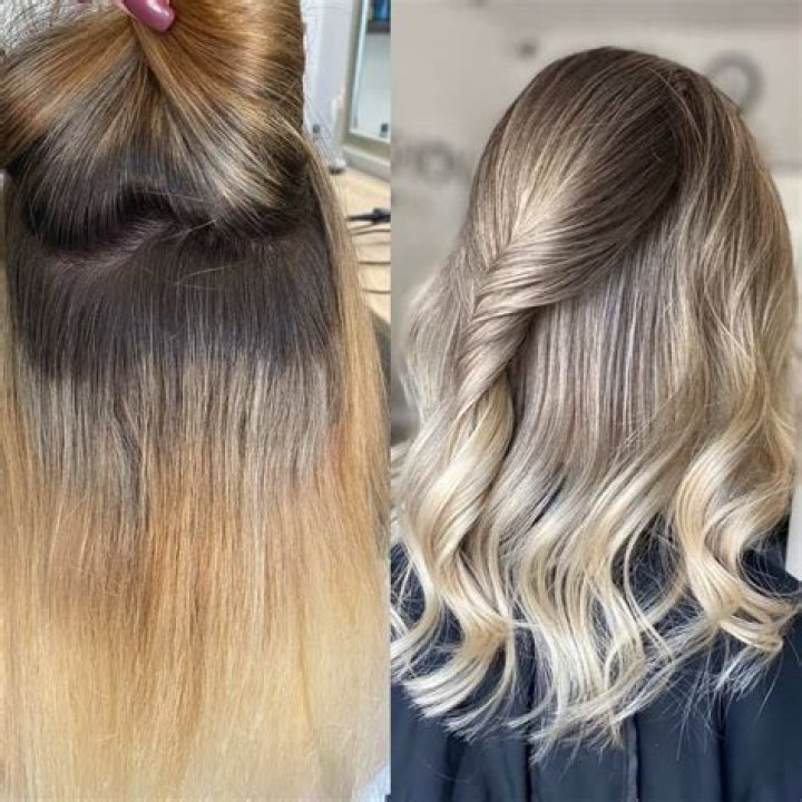 Can blonde hair be removed by laser?