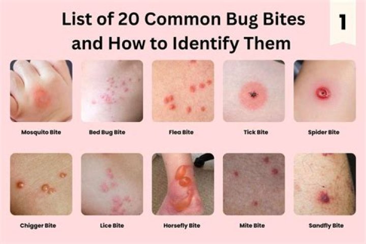 Can bug bites show up 2 days later?