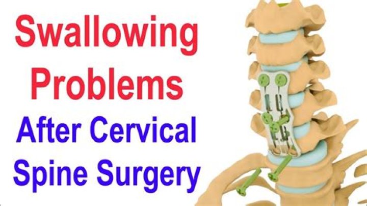 Can cervical spine problems cause swallowing problems?