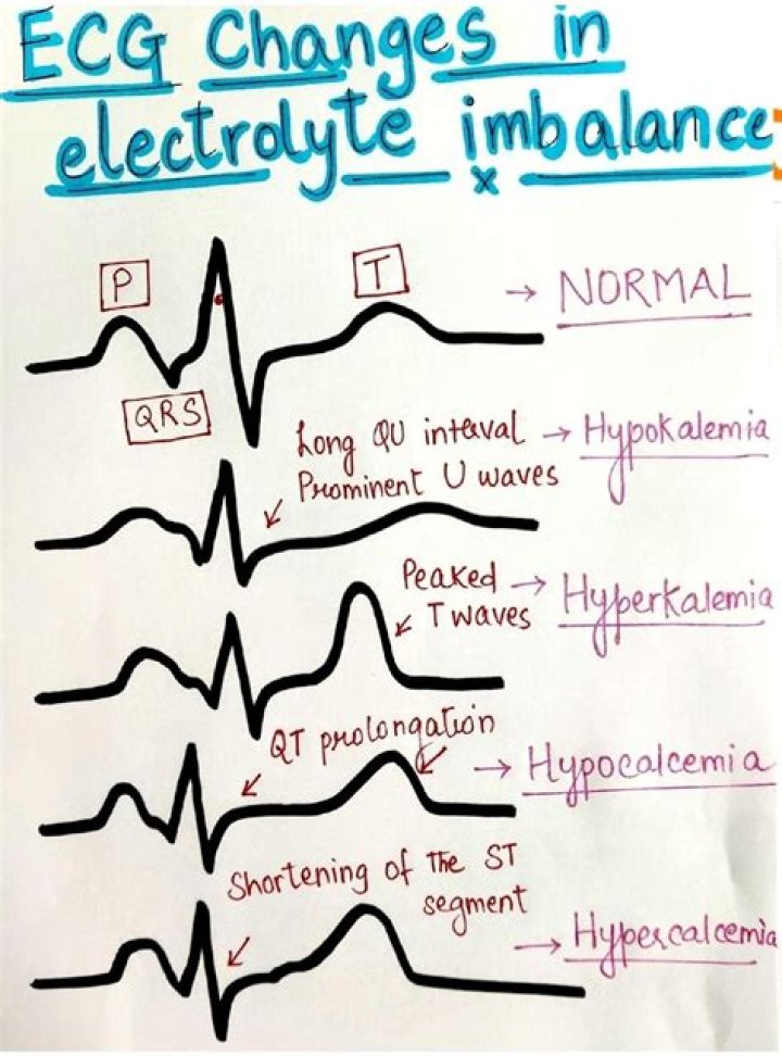 Can ECG detect electrolyte imbalance?