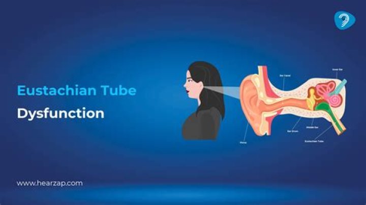 Can Eustachian tubes cause neck pain?
