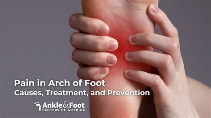Can fallen arches cause foot pain?