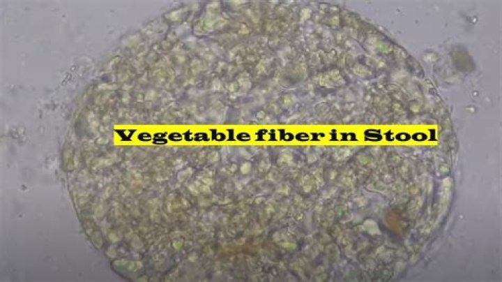 Can fat be excreted through stool?