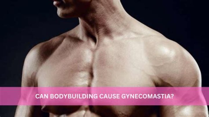 Can gynecomastia be caused by steroids?