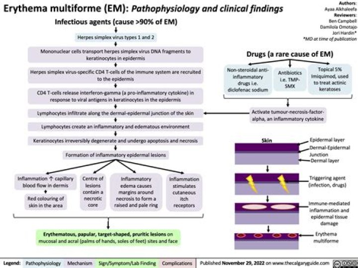 Can hsv2 cause erythema multiforme?
