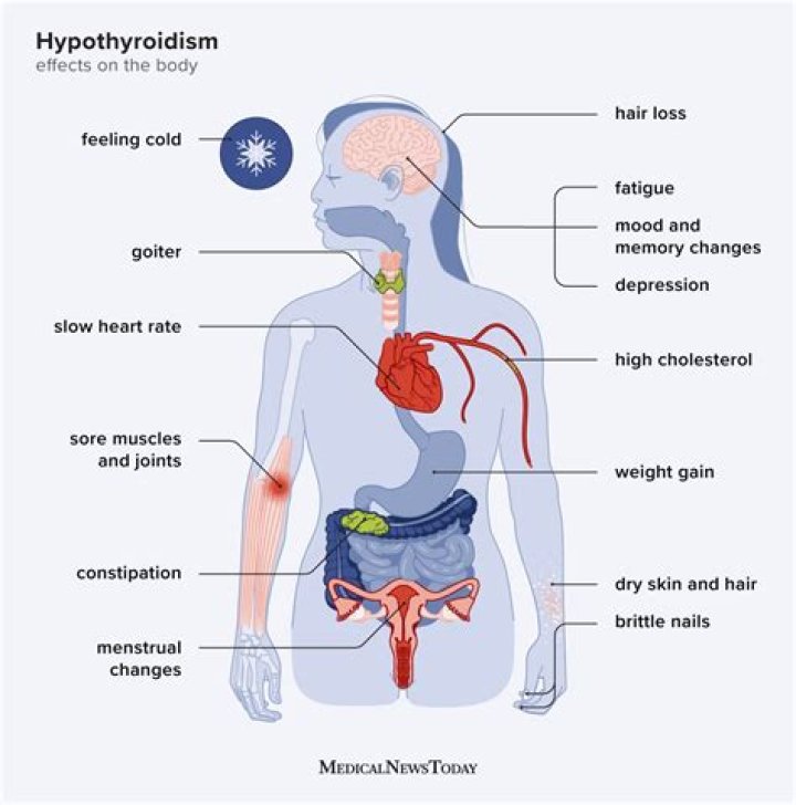 Can hypothyroidism cause low BBT?