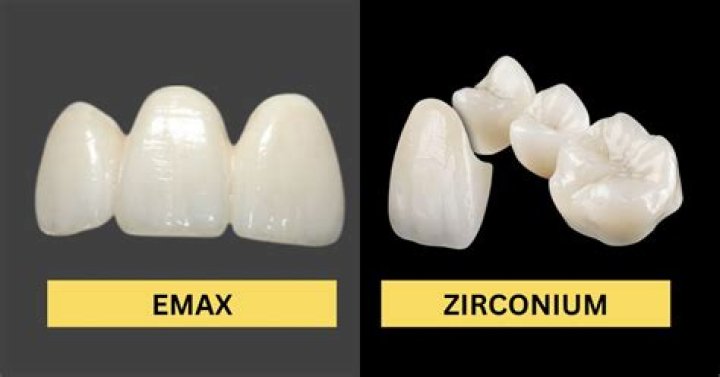 Can I use zirconia for my bridge?