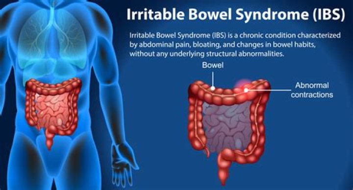 Can IBS with constipation be cured?