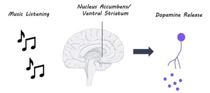 Can music cause seizures?