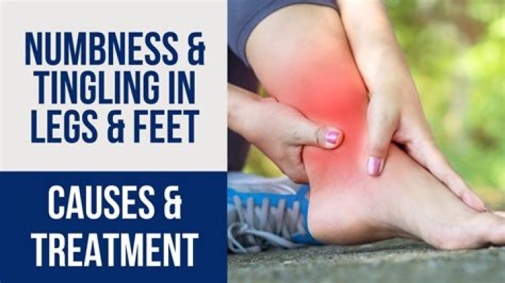 Can neck problems cause leg numbness?