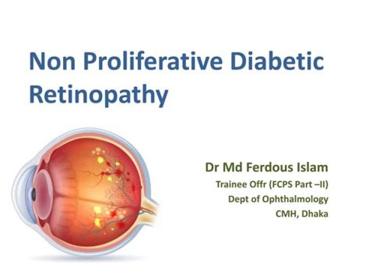 Can non proliferative diabetic retinopathy be cured?