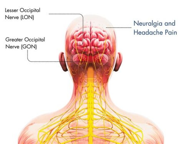 Can occipital neuralgia make you dizzy?