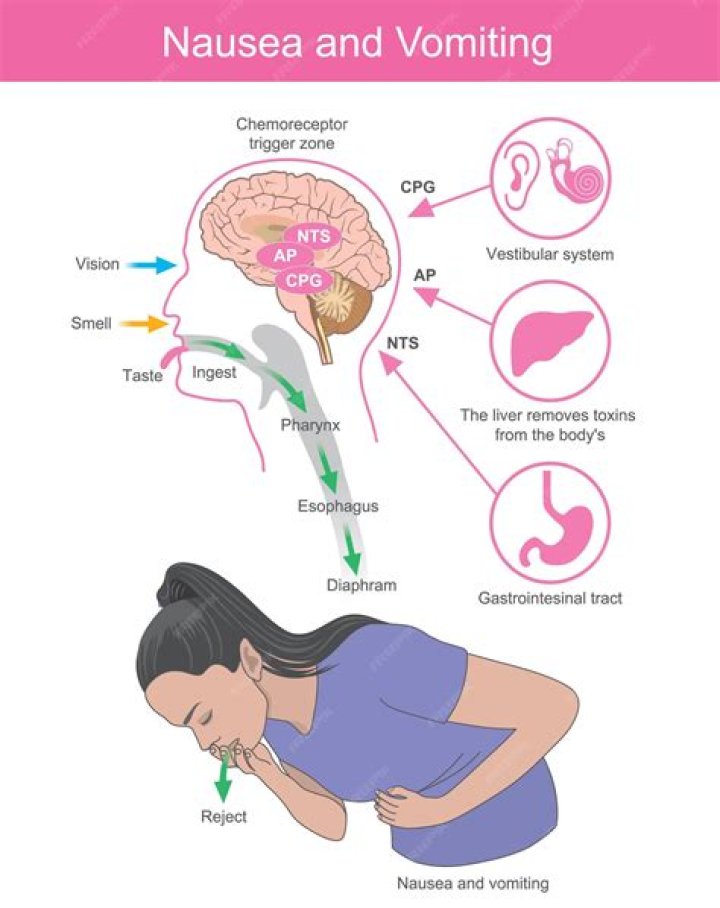Can ocella cause nausea?