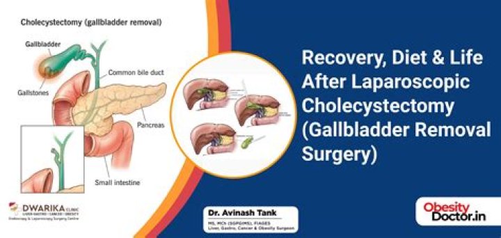 Can reflux get worse after gallbladder surgery?