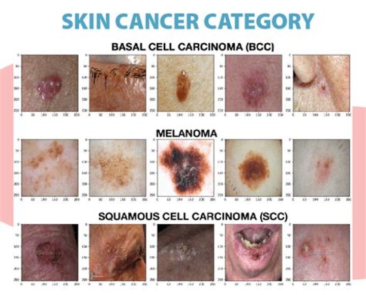Can skin cancer be pink in color?