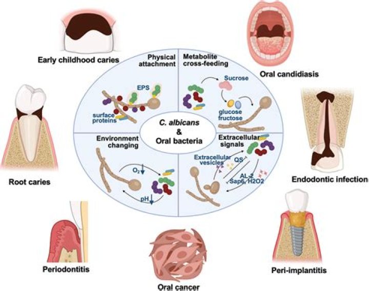Can systemic candida be cured?