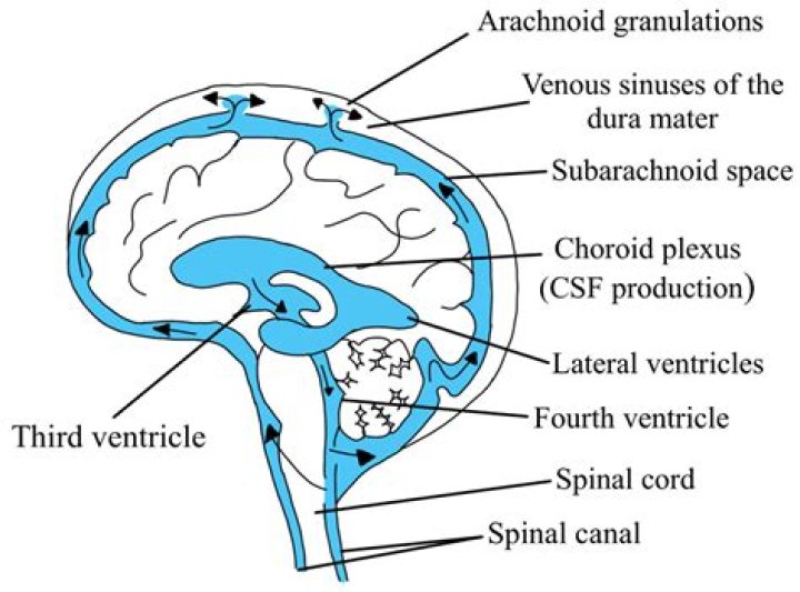 Can Tumors be fluid filled?