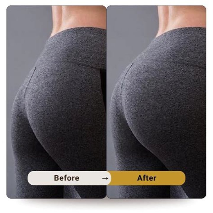 Can you exercise with butt fillers?