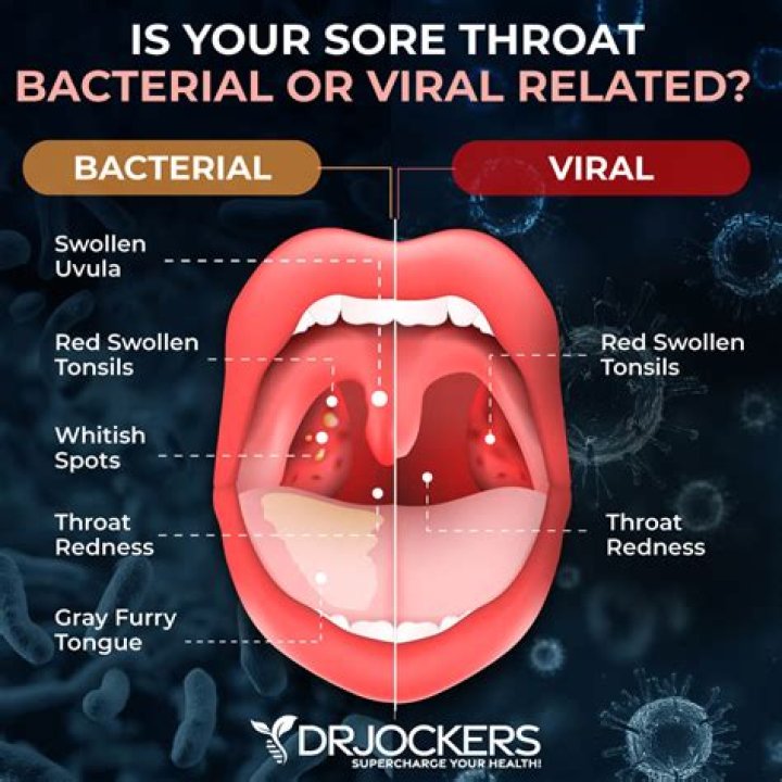 Can you get a sore throat with hives?