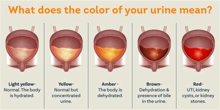 Can you have a UTI with blood and no pain?