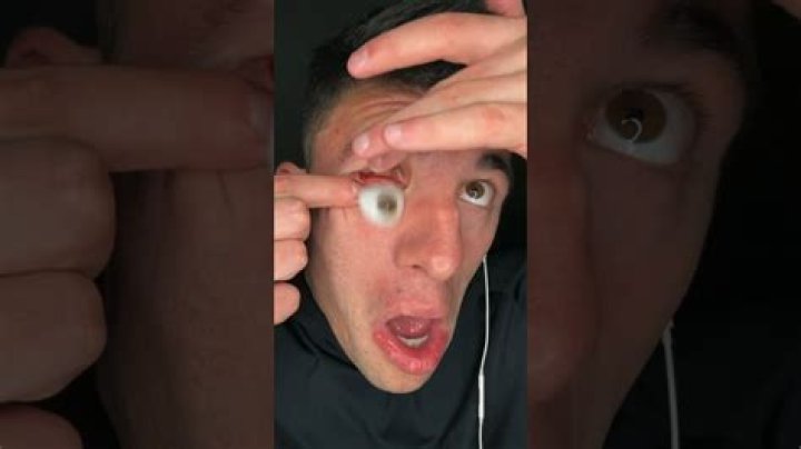 Can you take your eyeball out?