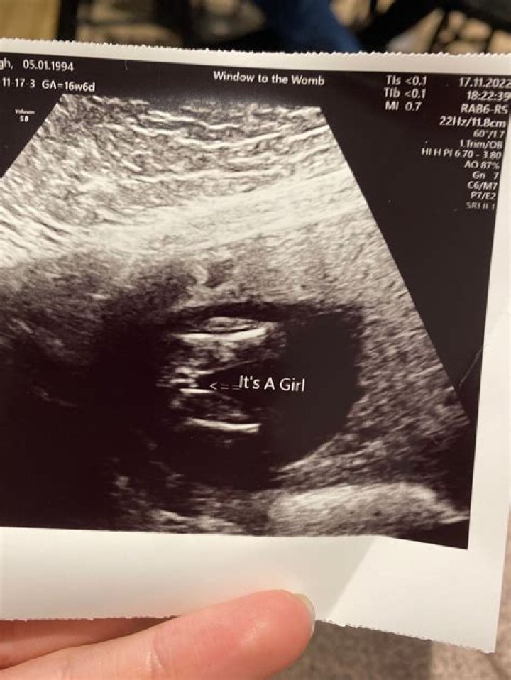 Can you tell gender at 16 weeks ultrasound?