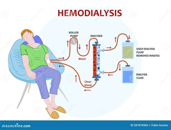 Can you use warfarin in hemodialysis?