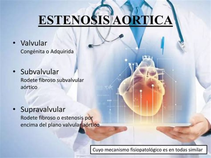 Como detectar la insuficiencia aortica?
