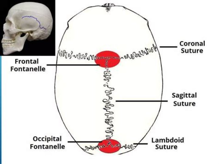 Do Fontanels become sutures?