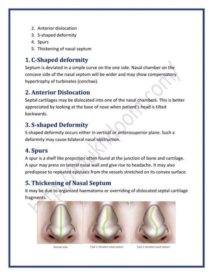 Do septal spurs cause headaches?