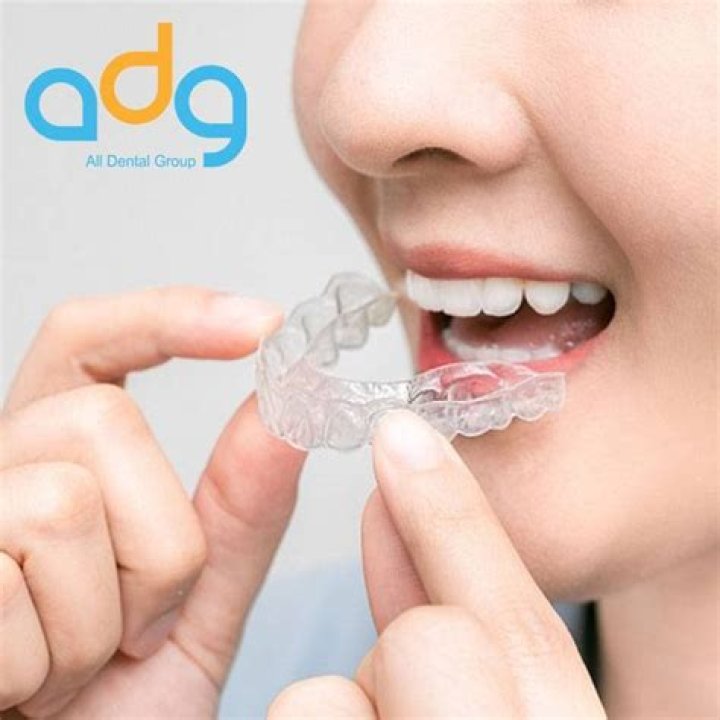 Do you have to wear a retainer forever?