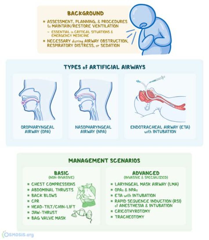 Does airway take priority over a spinal injury?