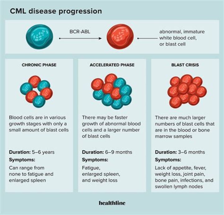 Does AML have blasts?