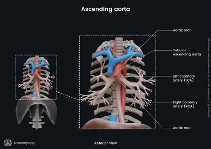 Does aorta cause back pain?