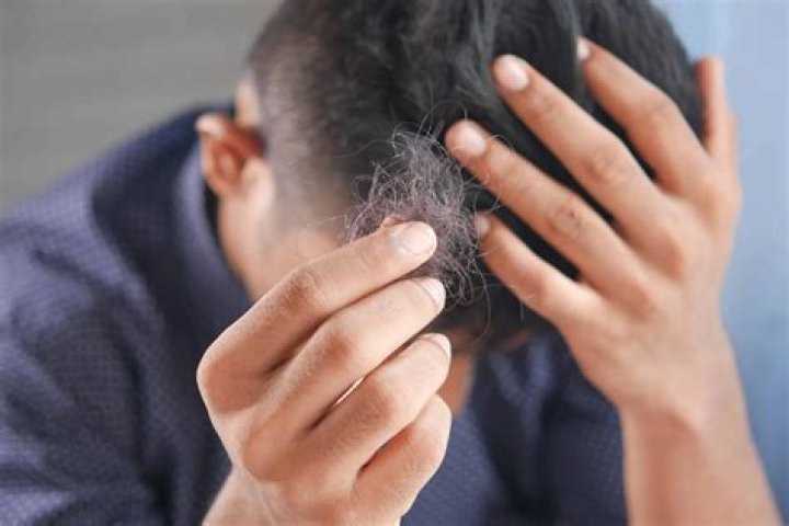 Does bed rest cause hair loss?