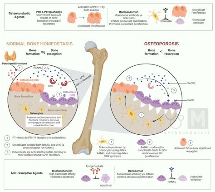 Does carbonated drinks cause osteoporosis?