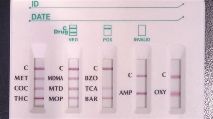 Does Demerol show on a drug test?