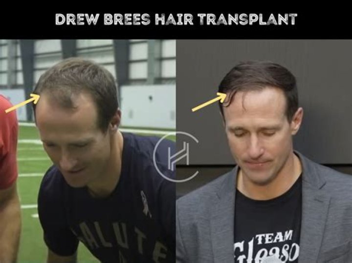 Does Drew Brees have a long neck?