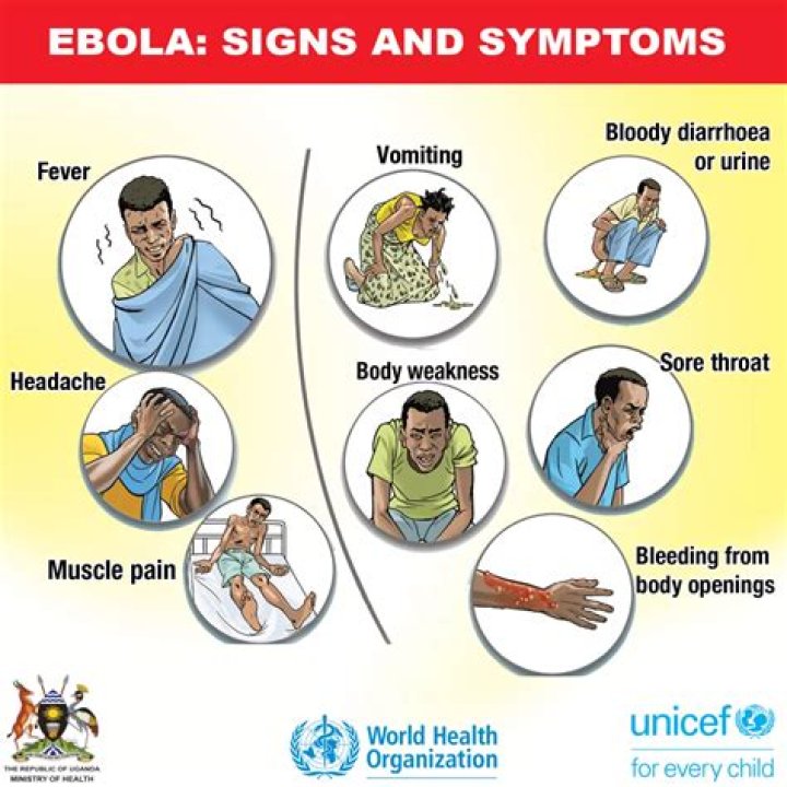 Does Ebola cause external bleeding?
