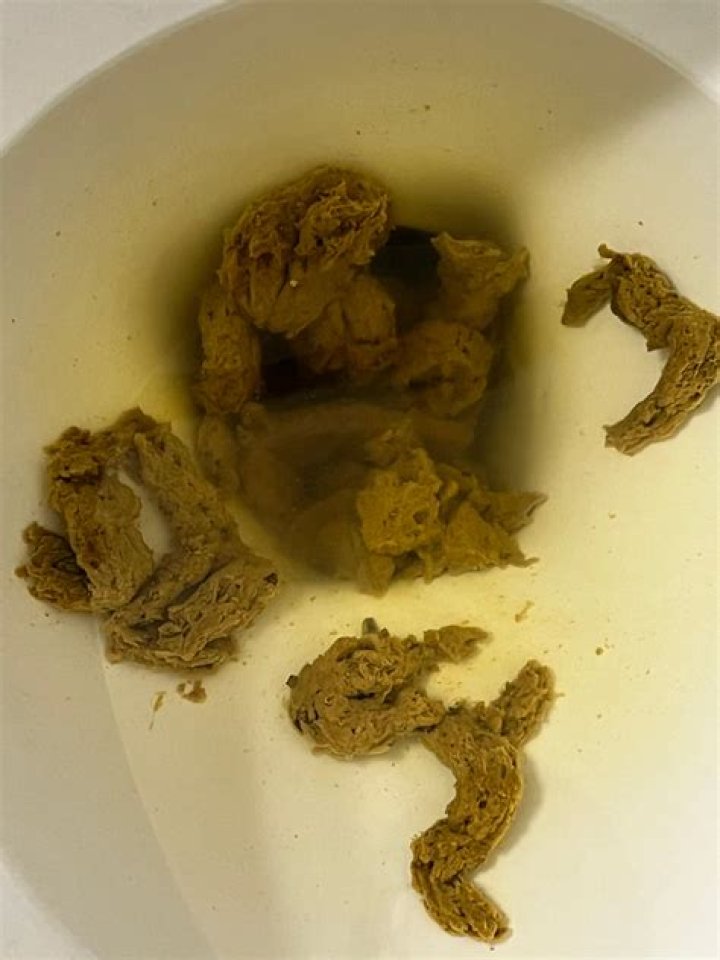 Does fasting make you poop?