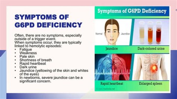 Does G6PD cause anemia?